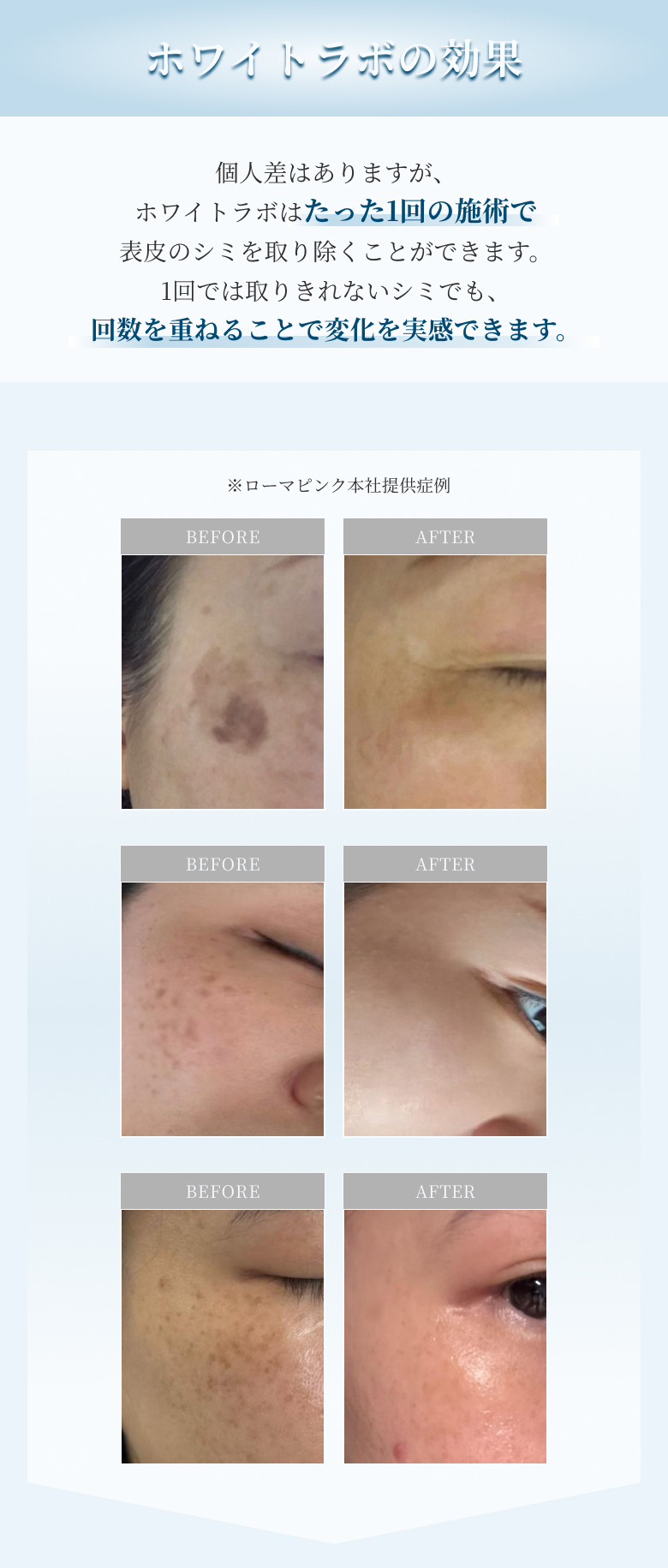 ホワイトラボの効果